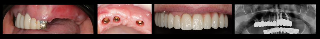 01 mp4 1